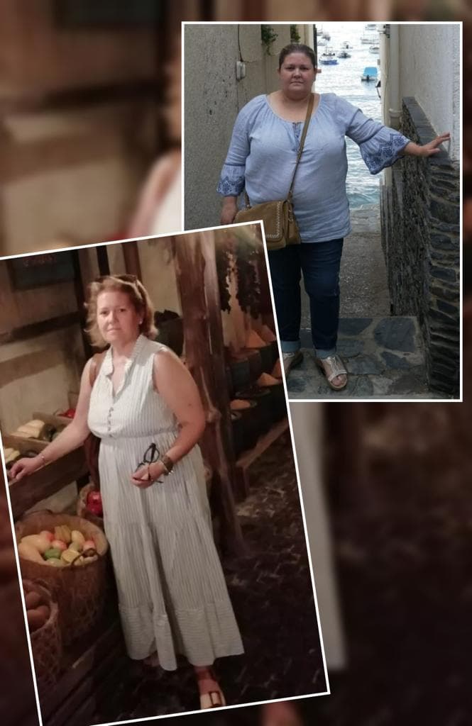 Paciente de by-pass gástrico laparoscópico en Castellón